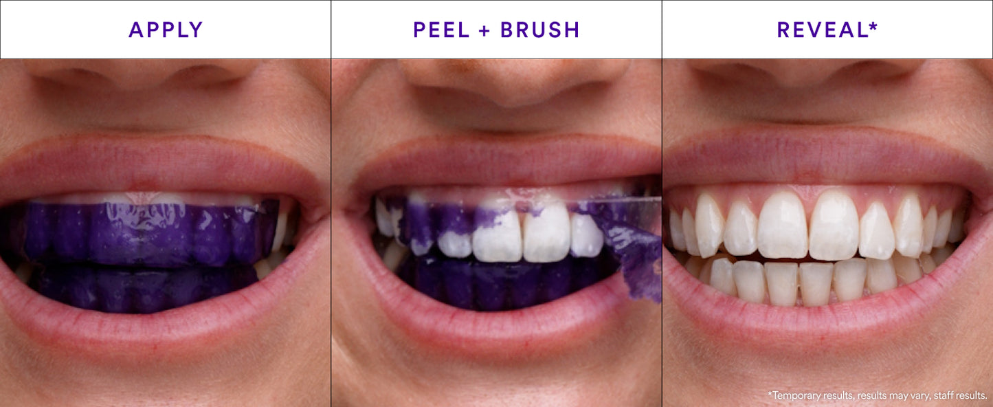 Purple Teeth Whitening Strips