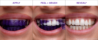 Purple Teeth Whitening Strips