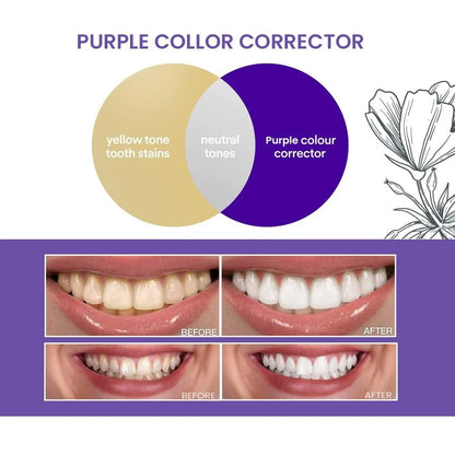Purple Teeth Whitening Strips